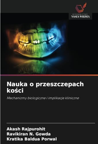 Nauka o przeszczepach kości: Mechanizmy biologiczne i implikacje kliniczne von Wydawnictwo Nasza Wiedza