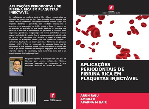 APLICAÇÕES PERIODONTAIS DE FIBRINA RICA EM PLAQUETAS INJECTÁVEL von Edições Nosso Conhecimento