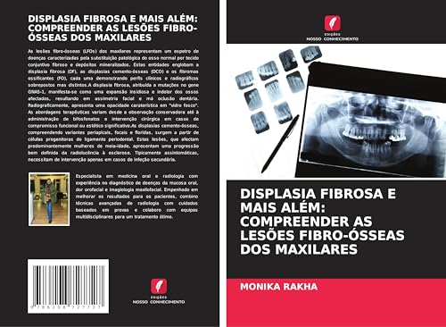 DISPLASIA FIBROSA E MAIS ALÉM: COMPREENDER AS LESÕES FIBRO-ÓSSEAS DOS MAXILARES von Edições Nosso Conhecimento