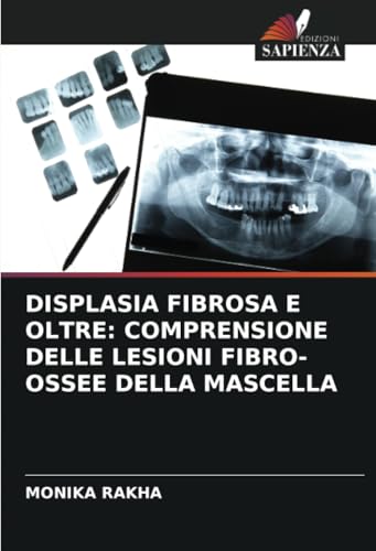 DISPLASIA FIBROSA E OLTRE: COMPRENSIONE DELLE LESIONI FIBRO-OSSEE DELLA MASCELLA von Edizioni Sapienza