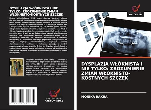 DYSPLAZJA W¿ÓKNISTA I NIE TYLKO: ZROZUMIENIE ZMIAN W¿ÓKNISTO-KOSTNYCH SZCZ¿K: DE von Wydawnictwo Nasza Wiedza