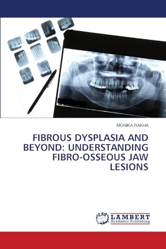 FIBROUS DYSPLASIA AND BEYOND: UNDERSTANDING FIBRO-OSSEOUS JAW LESIONS von LAP LAMBERT Academic Publishing