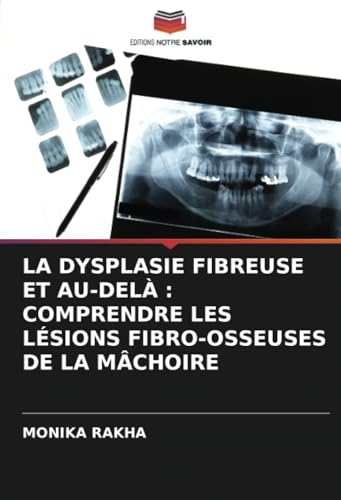 LA DYSPLASIE FIBREUSE ET AU-DELÀ : COMPRENDRE LES LÉSIONS FIBRO-OSSEUSES DE LA MÂCHOIRE von Editions Notre Savoir