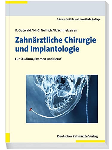 Zahnärztliche Chirurgie und Implantologie: Für Studium, Examen und Beruf von Deutscher Aerzte Verlag