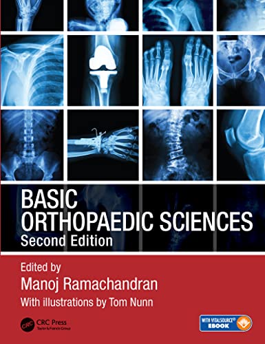 Basic Orthopaedic Sciences von CRC Press