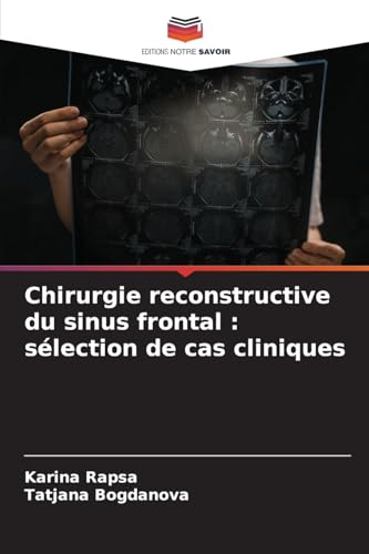 Chirurgie reconstructive du sinus frontal : sélection de cas cliniques von Editions Notre Savoir