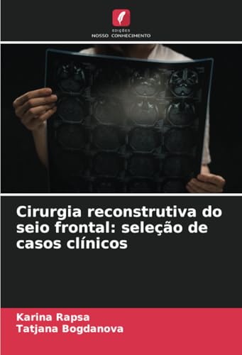 Cirurgia reconstrutiva do seio frontal: seleção de casos clínicos von Edições Nosso Conhecimento