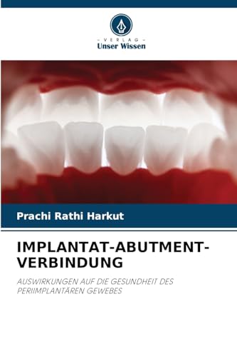 IMPLANTAT-ABUTMENT-VERBINDUNG: AUSWIRKUNGEN AUF DIE GESUNDHEIT DES PERIIMPLANTÄREN GEWEBES IMPLANTAT-ABUTMENT-VERBINDUNG: AUSWIRKUNGEN AUF DIE GESUNDHEIT DES PERIIMPLANTÄREN GEWEBES