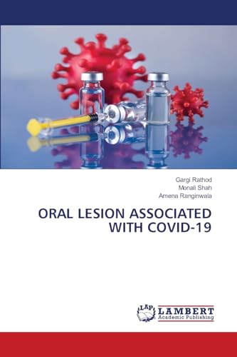 ORAL LESION ASSOCIATED WITH COVID-19: DE von LAP LAMBERT Academic Publishing