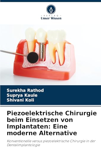 Piezoelektrische Chirurgie beim Einsetzen von Implantaten: Eine moderne Alternative: Konventionelle versus piezoelektrische Chirurgie in der Dentalimplantologie von Verlag Unser Wissen
