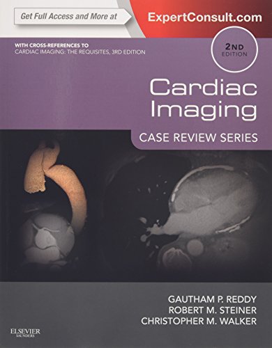Cardiac Imaging: Case Review Series: Case Review Series Cardiac Imaging: Case Review Series: Case Review Series von Saunders