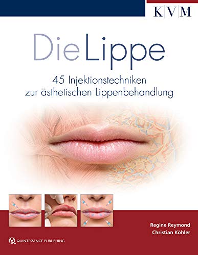 Die Lippe: 45 Injektionstechniken zur ästhetischen Lippenbehandlung