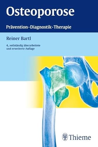 Osteoporose
