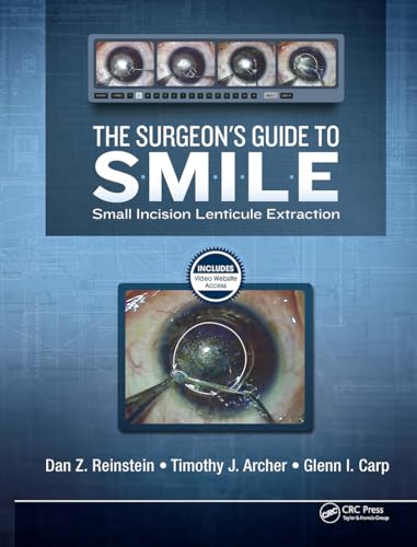 The Surgeon's Guide to Smile: Small Incision Lenticule Extraction