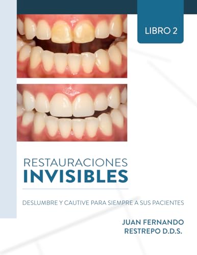Restauraciones Invisibles: Deslumbre Y Cautive Para Siempre A Sus Pacientes von ibukku, LLC