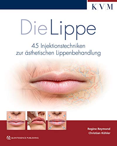 Die Lippe: 45 Injektionstechniken zur ästhetischen Lippenbehandlung von KVM-Der Medizinverlag