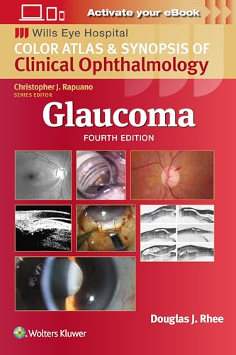 Glaucoma: Wills Eye Institute Atlas Series von Lippincott Williams&Wilki