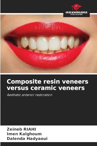 Composite resin veneers versus ceramic veneers: Aesthetic anterior restoration von Our Knowledge Publishing