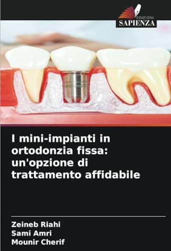 I mini-impianti in ortodonzia fissa: un'opzione di trattamento affidabile: DE von Edizioni Sapienza