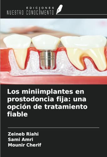 Los miniimplantes en prostodoncia fija: una opción de tratamiento fiable von Ediciones Nuestro Conocimiento