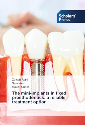 The mini-implants in fixed prosthodontics: a reliable treatment option: DE von Scholars' Press