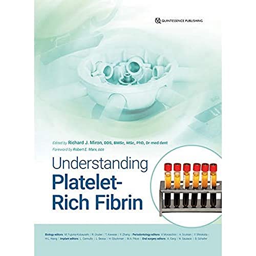 Understanding Platelet Rich Fibrin von Quintessence Publishing