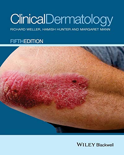 Clinical Dermatology