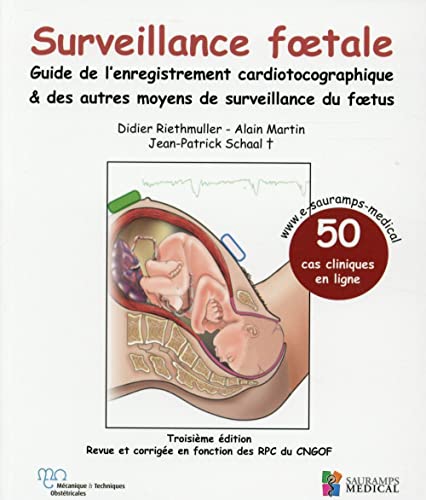 SURVEILLANCE FOETALE - GUIDE DE L'ENREGISTREMENT CARDIOTOCOGRAPHIQUE & AUTRES MO: Guide de l'enregistrement cardiotocographique & des autres moyens de surveillance du foetus