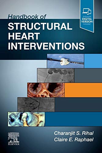 Handbook of Structural Heart Interventions von Elsevier