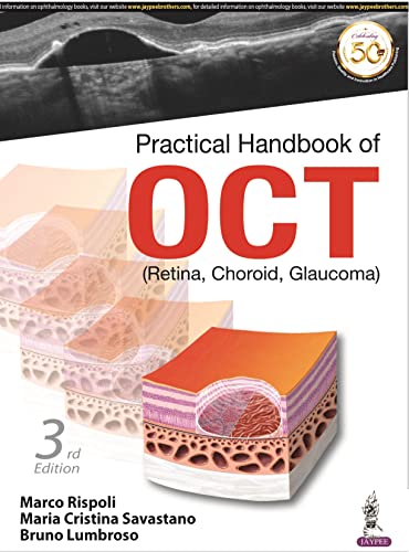 Practical Handbook of OCT: Retina, Choroid, Glaucoma von Jaypee Brothers Medical Publishers