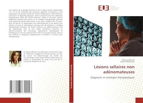 Lésions sellaires non adénomateuses: Diagnostic et stratégies thérapeutiques von Éditions universitaires européennes