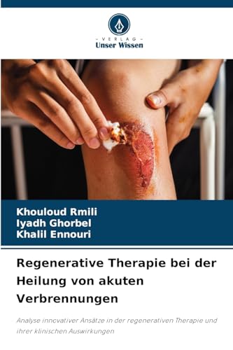 Regenerative Therapie bei der Heilung von akuten Verbrennungen: Analyse innovativer Ansätze in der regenerativen Therapie und ihrer klinischen Auswirkungen von Verlag Unser Wissen