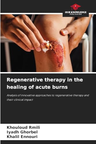Regenerative therapy in the healing of acute burns: Analysis of innovative approaches to regenerative therapy and their clinical impact von Our Knowledge Publishing
