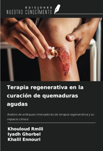 Terapia regenerativa en la curación de quemaduras agudas: Análisis de enfoques innovadores de terapia regenerativa y su impacto clínico von Ediciones Nuestro Conocimiento