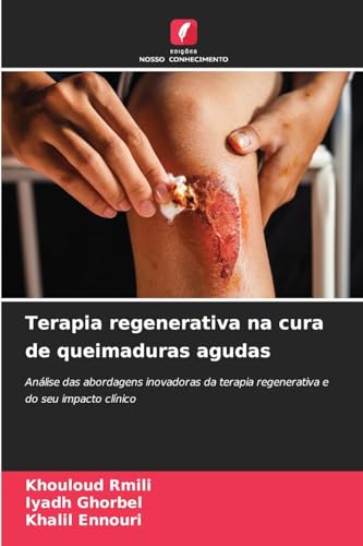 Terapia regenerativa na cura de queimaduras agudas: Análise das abordagens inovadoras da terapia regenerativa e do seu impacto clínico von Edições Nosso Conhecimento