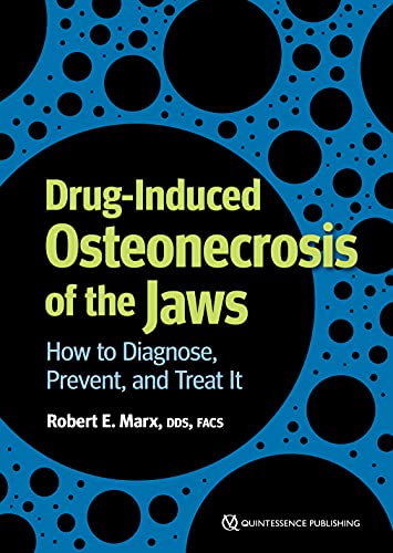 Drug-Induced Osteonecrosis of the Jaws: How to Diagnose, Prevent, and Treat It
