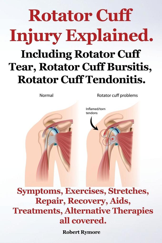 Rotator Cuff Injury Explained. Including Rotator Cuff Tear Rotator Cuff Bursitis Rotator Cuff Tendonitis. Symptoms Exercises Stretches Repair Re von IMB Publishing