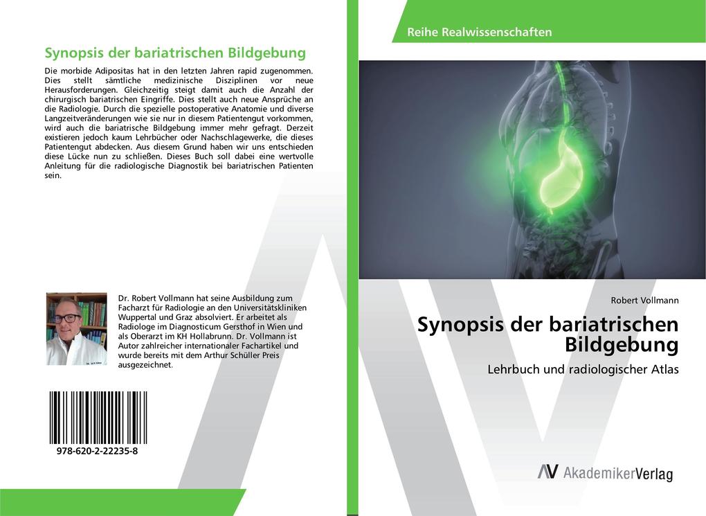 Synopsis der bariatrischen Bildgebung von AV Akademikerverlag