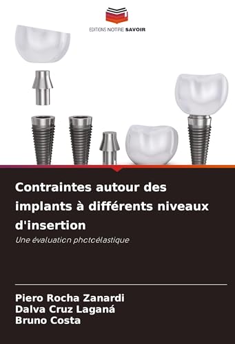 Contraintes autour des implants à différents niveaux d'insertion: Une évaluation photoélastique von Editions Notre Savoir