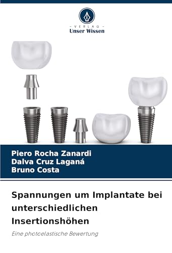 Spannungen um Implantate bei unterschiedlichen Insertionshöhen: Eine photoelastische Bewertung von Verlag Unser Wissen