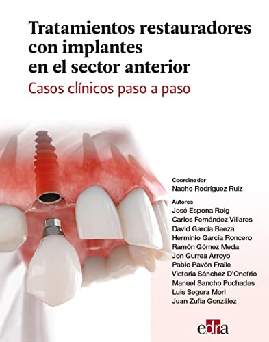 Tratamientos restauradores con implantes en el sector anterior. Casos clínicos paso a paso. Tratamientos restauradores con implantes en el sector anterior. Casos clínicos paso a paso.
