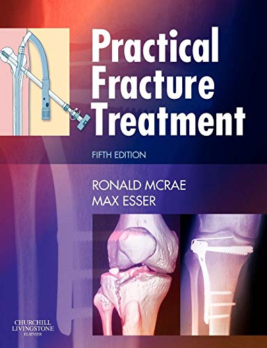 Practical Fracture Treatment, Fith Edition von Churchill Livingstone