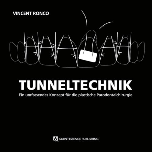 Tunneltechnik: Ein umfassendes Konzept für die plastische Parodontalchirurgie Tunneltechnik: Ein umfassendes Konzept für die plastische Parodontalchirurgie von Quintessence Publishing
