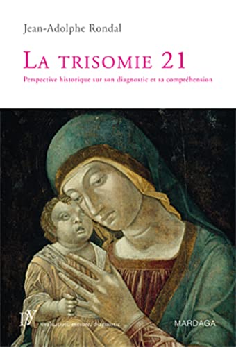 La trisomie 21: Perspective historique sur son diagnostic et sa compréhension
