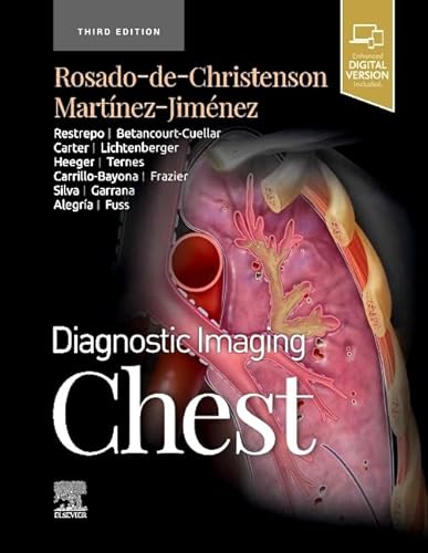 Diagnostic Imaging: Chest von Elsevier