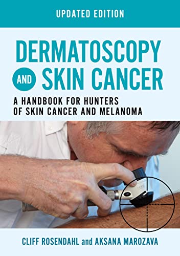 Dermatoscopy and Skin Cancer: A Handbook for Hunters of Skin Cancer and Melanoma (General Practice) von Scion Publishing Ltd