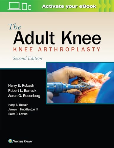 The Adult Knee: Knee Arthroplasty von LWW