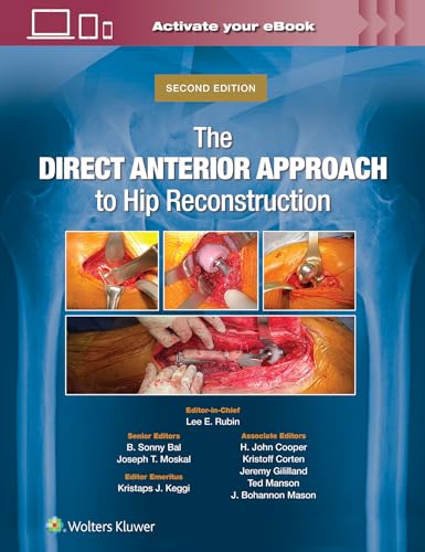 The Direct Anterior Approach to Hip Reconstruction