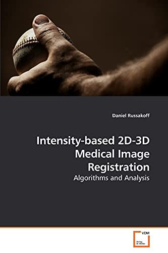 Intensity-based 2D-3D Medical Image Registration: Algorithms and Analysis von VDM Verlag