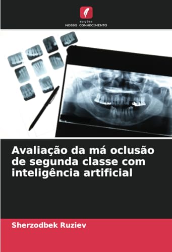 Avaliação da má oclusão de segunda classe com inteligência artificial von Edições Nosso Conhecimento